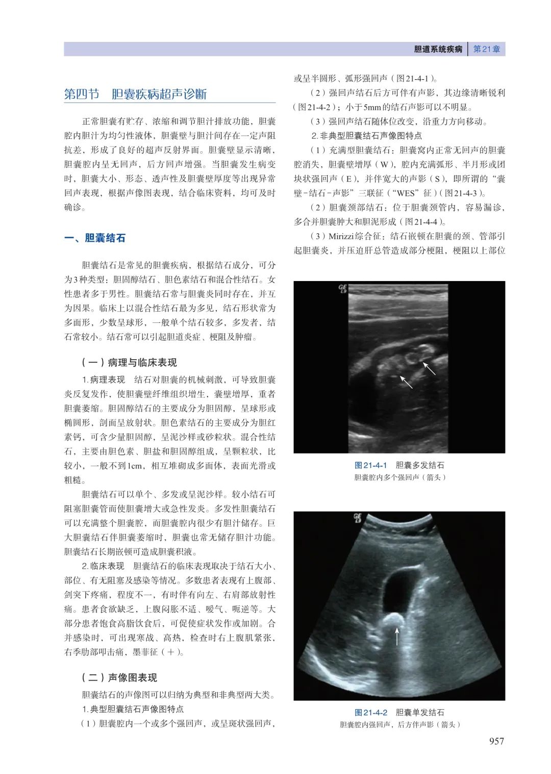 最新超声技术，医疗诊断的先锋革新力量